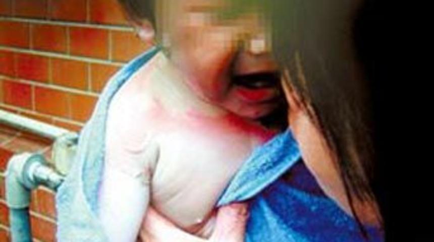 Bebeğini kaynar suya attı