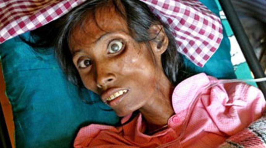 AİDS'i yok edecek prezervatif