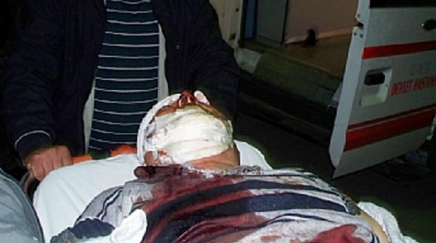 Miras y&uuml;z&uuml;nden &uuml;vey amcasını satırla yaraladı