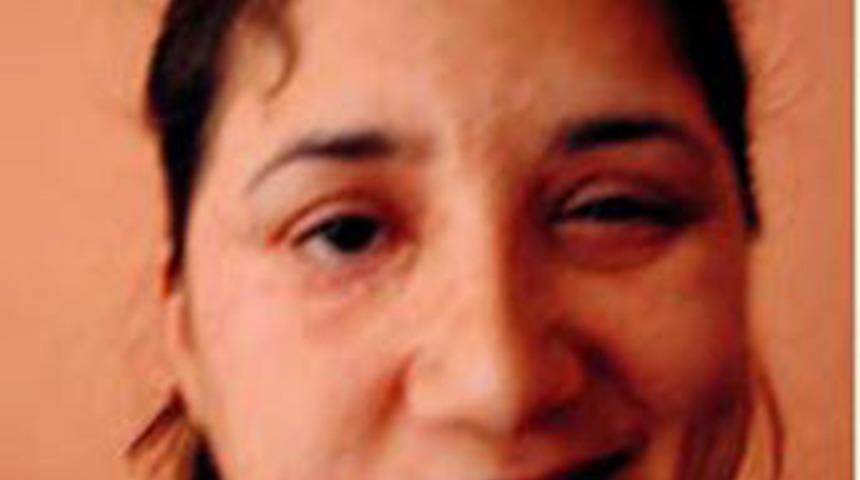 "Bonus estetik" bu hale getirdi