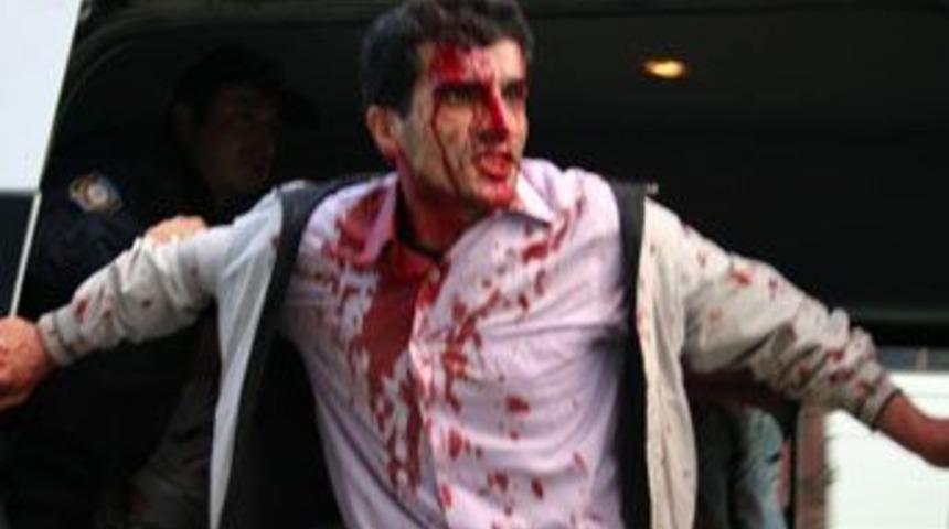 Siirt'te taşlı sopalı kavga: 6 yaralı