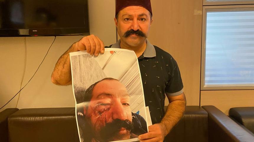 Gaziosmanpaşa’da ablasının kiracısını darbeden sanık tahliye edildi