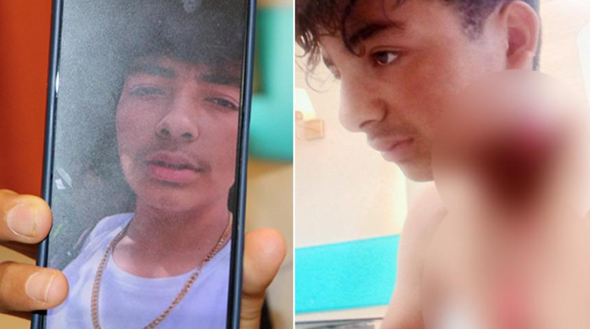 Şoke eden olay! Yaylada hayvan otlatırken başlarına geldi... Birinin boynundaki kolye parçalandı: Bulunduğu bölge yandı