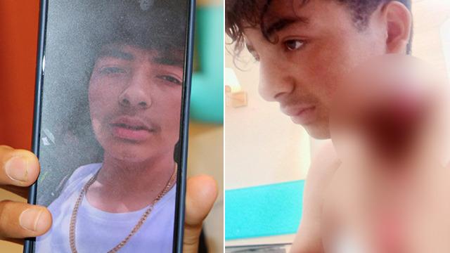 Şoke eden olay! Yaylada hayvan otlatırken başlarına geldi... Birinin boynundaki kolye parçalandı: Bulunduğu bölge yandı