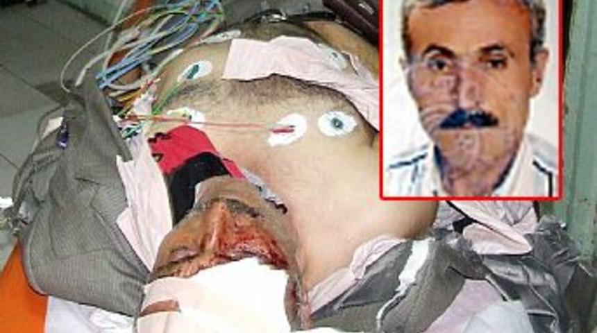 Kıbrıs Gazisi başından vurulmuş bulundu