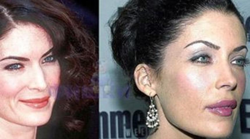 Silikonlu g&uuml;zeller