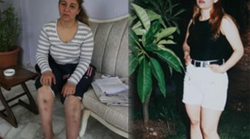 10 santim uzamak istedi hayatı karardı