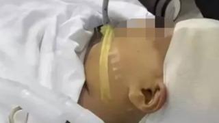 Çin'de skandal görüntüler! 9 yaşındaki öğrenci öğretmeni tarafından darp edildi... Metal cetvelle defalarca kafasına vurulunca hastanelik oldu