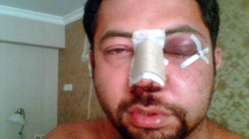 Dayak değil kayak mağduru