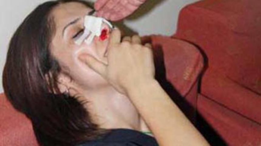 Acilde yumruklanan hemşirenin burnu kırıldı