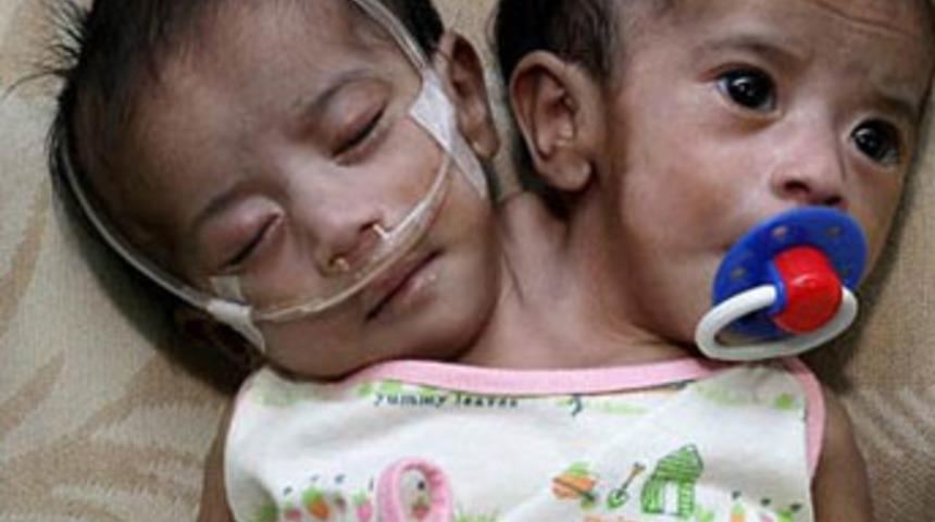 Bu bebeklere y&uuml;rek dayanmıyor