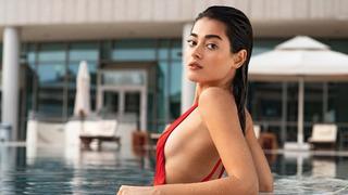 Yabani'nin Rüya'sı Simay Barlas'ın estetiksiz hali ortaya çıktı! Görenler şoke oldu