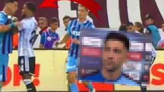 Boynu çizik ve morluklar içinde... Bakasetas'ın Beşiktaş maçı sonrası röportaj sırasındaki görüntüsü olay oldu!