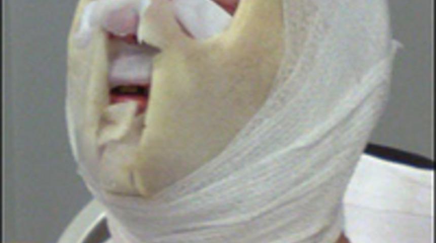 "Patates gibi kızardığımı hissettim"