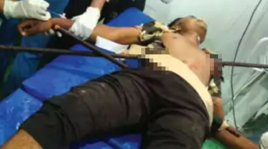 Mucize kurtuluş! İnşaat işçisi metrelerce yüksekten demir çubukların üzerine düştü... Santimlerle hayatta kaldı 