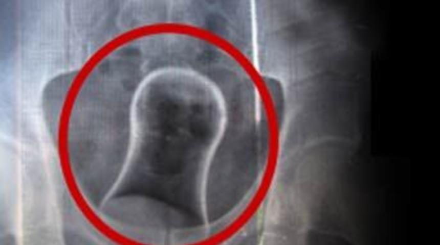 Alacak kavgasında g&ouml;r&uuml;lmemiş işkence