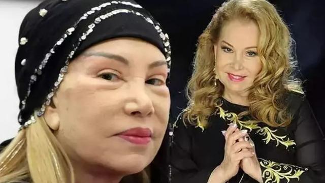 83 yaşında yüz ve boyun gerdiren Bedia Akartürk: 10 sene sonrasını düşündüm, roketledim