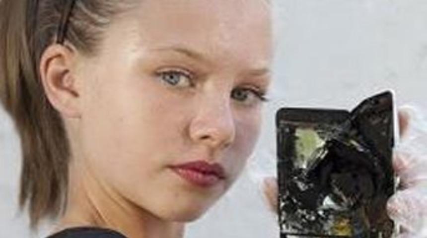 iPod'u elinde patladı