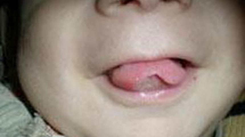 Dilini ve parmaklarını yedi