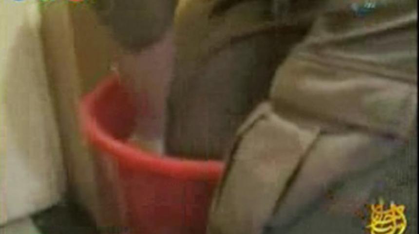 İşte işkencenin kanıtı