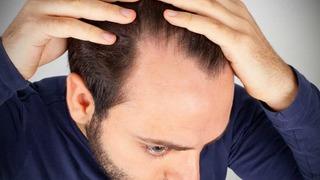 Saç dökülmesine iyi geliyor! En pahalı şampuandan bile etkili, denemeden geçmeyin