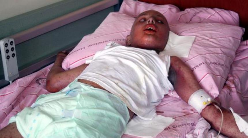 Kanserli çocuk 'yüksek dozda ilaçtan öldü' iddiası