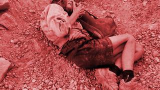 Düştüğü çukurda 3 gün boyunca yaşama tutunmuş! Fransız gezginden yeni haberi: Bel ve kaburgsında kırıklar var