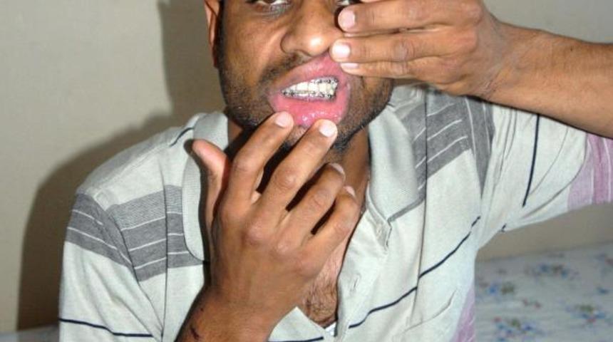 Gözaltında işkence iddiası