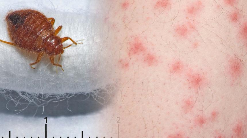 Fransa'nın başkenti Paris'te tahtakurusu istilası! Hükümet müdahale kararı: 'Hiç kimse güvende değil' 