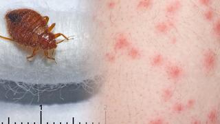 Fransa'nın başkenti Paris'te tahtakurusu istilası! Hükümet müdahale kararı: 'Hiç kimse güvende değil' 