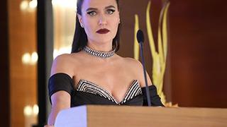 Şevval Sam Botoks yaptırmak istemememin tek sebebi diyerek açıkladı!