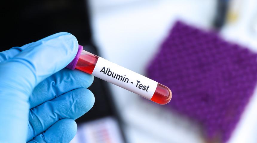 Albumin nedir? Albumin düşüklüğü tehlikeli mi?