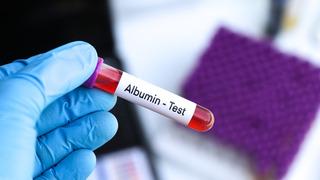 Albumin nedir? Albumin düşüklüğü tehlikeli mi?