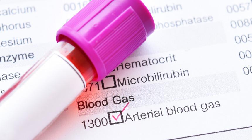 PO2 (kan gazı) nedir? PO2 kaç olursa tehlikeli?	