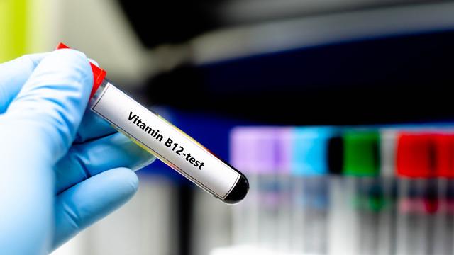 B12 düşüklüğü neden olur? B12 çok düşükse ne yapılmalı?	