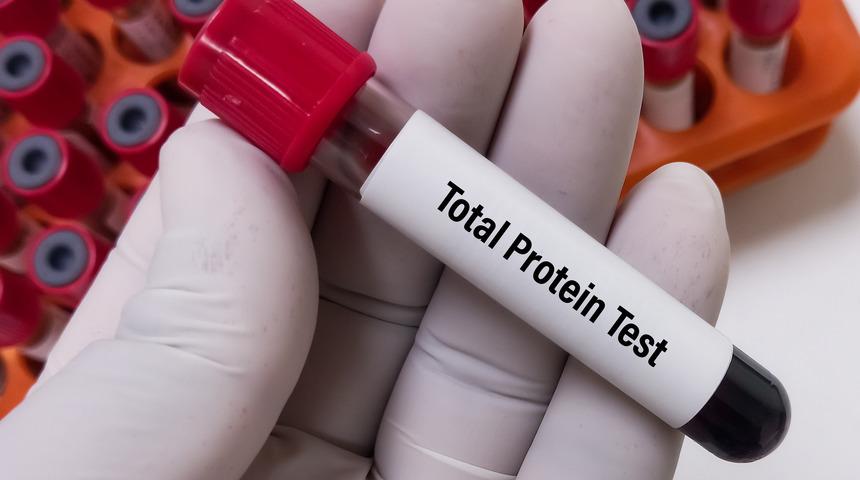 Total protein testi nedir? Total protein düşüklüğü neden olur?
