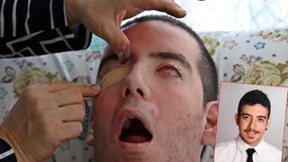 Halil'in dramı! 10 yıldır gözlerini kapatamıyor: Anne hiçbir şey istemiyorum...