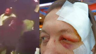 'Bıçağı kafama sapladı' Dükkanında otururken bir ses duyunca dışarı çıktı! Esnaf, dehşeti yaşadı