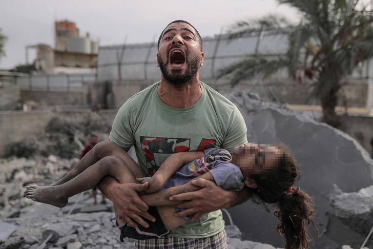 Gazze'de acı ve gözyaşı! Bombardıman altındaki bölgeden korkunç kareler G1