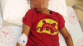 Adana'da kan donduran olay! 8 yaşındaki çocuğu kasığından vurup, 'Yarım kalan işi tamamlayacağız' diye mesajlar atıyorlar