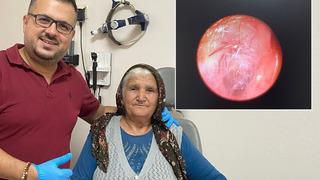 Kulağındaki hışırtı için hastaneye gitti... Doktor gözlerine inanamadı, o hayatının şokunu yaşadı! Yuva yapmış 'Canlıydı'