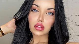 Cinsiyet değiştirip 30'a yakın ameliyat geçirmişti! Beren Güney dolgularını eritti! Görenler tanıyamadı