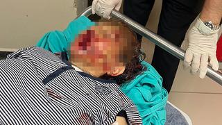 Adana'da torun vahşeti! Demir kürekle darp etti