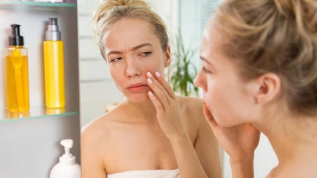 Kış mevsiminde cilt hastalıkları tetiklenebiliyor! Uzmanından altın değerinde tavsiye