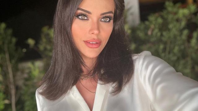 Tuvana Türkay'ın estetiksiz halini görenler tanıyamadı! Sadece ismi aynı