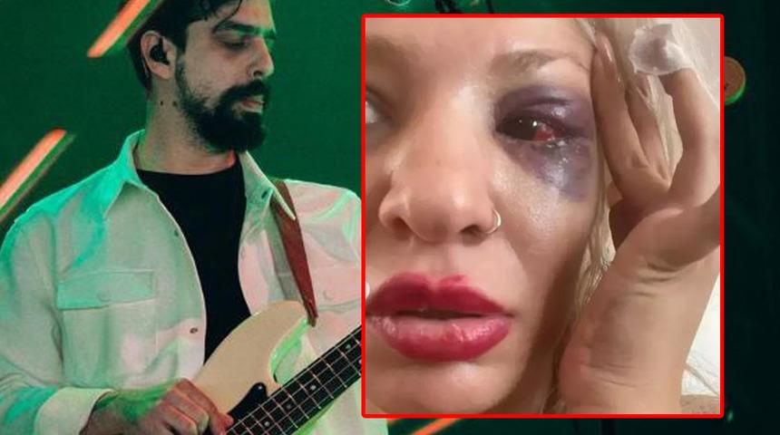 Y&uuml;zy&uuml;zeyken Konuşuruz'un gitaristi Can Tunaboylu sevgilisini darp ettiği iddialarıyla g&uuml;ndemde! Soruşturma a&ccedil;ıldı