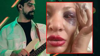 Yüzyüzeyken Konuşuruz'un gitaristi Can Tunaboylu sevgilisini darp ettiği iddialarıyla gündemde! Soruşturma açıldı