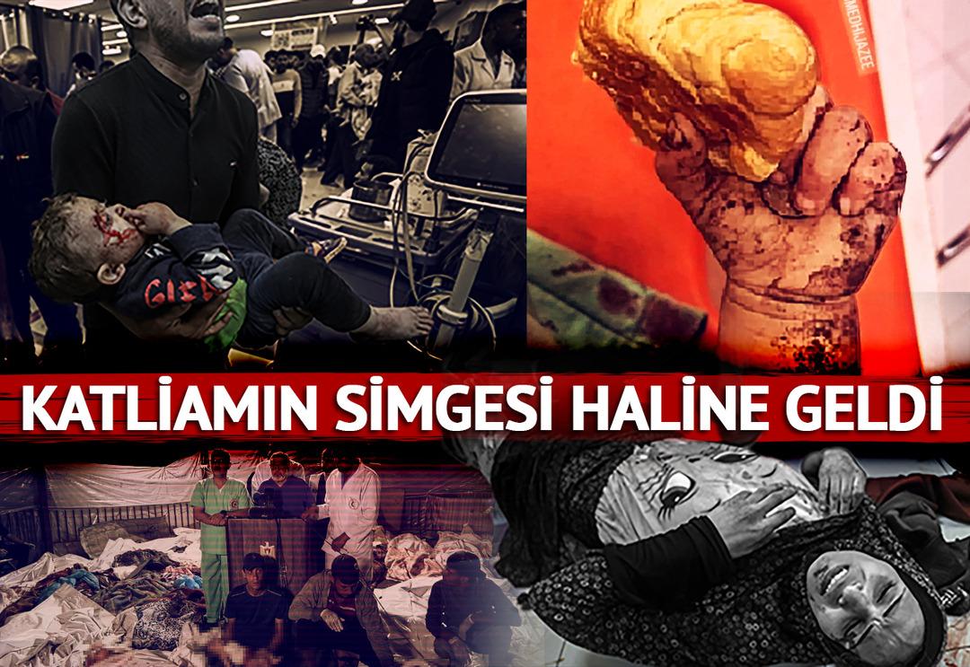 İsrail'den k&uuml;stah &ccedil;ıkış! Mezarlıkta basın toplantısı... Hastane katliamının simgesi haline geldi: D&uuml;nya o bebeği konuşuyor