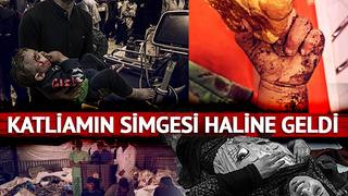 İsrail'den küstah çıkış! Mezarlıkta basın toplantısı... Hastane katliamının simgesi haline geldi: Dünya o bebeği konuşuyor