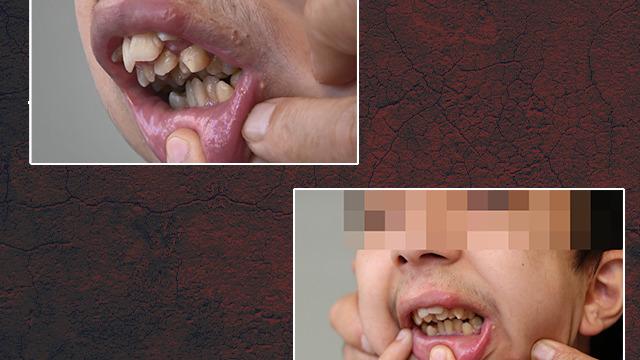 17 yaşındaki gencin büyük dramı! Ameliyat için yardım bekliyor: Bu hayatta en çok istediğim şey...